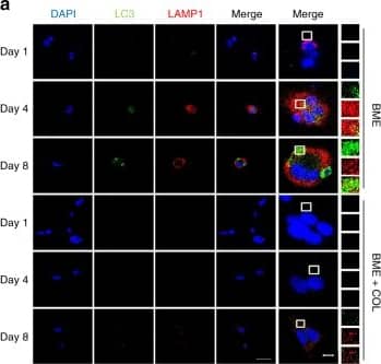 D2.0 R cells activate autophagy upon entering a dormant state. Representative images are shown for a Immunofluorescent staining of lysosomal (LAMP1, red) and autophagic (LC3, green) markers of D2.0 R cells in BME (upper panels) and BME + COL1 (lower panels) with b Quantification of the percentage of cells exhibiting LC3 positive puncta and LAMP1 staining out of the total number of cells analysed (mean +/- s.e.m, n = 30–42 cells. Comparisons are relative to Day 1 by Kruskal–Wallis, Dunn’s post test. *P ≤ 0.05; ****P ≤ 0.0001) and the average number of LC3 puncta per cell (Comparisons by Kruskal–Wallis, Dunn’s post test. **P ≤ 0.01 and ****P ≤ 0.0001). c D2.0 R cells transfected with the mCherry-GFP-LC3 reporter show activation and completion of the autophagic cycle (red fluorescence only) when plated in BME matrices for 8 days. d The graphs represent the percentage of cells with double-positive puncta (mCherry+ and GFP+) (autophagosomes) out of the total number of cells analysed (left graph) (mean +/- s.e.m, n = 35–39 cells). Comparisons by Kruskal–Wallis, Dunn’s post test. ****P ≤ 0.0001) and the rate of conversion from cells exhibiting yellow puncta to red-only puncta expressed as fold change (right graph). Scale bars are 50 and 10 μm for a and 20 and 10 μm for b Image collected and cropped by CiteAb from the following open publication (//pubmed.ncbi.nlm.nih.gov/29789598), licensed under a CC-BY license. Not internally tested by Novus Biologicals.