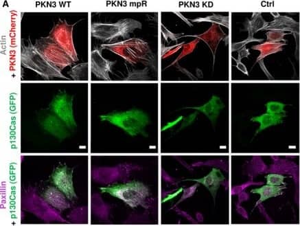 PKN3 activity is important for stress fibers formation & is stimulated by the expression of p130Cas. (A) p130Cas−/−MEFs growing on FN‐coated cover slips were co‐transfected by GFP‐p130Cas & mCherry‐PKN3 fusion variant (WT, mPR, KD) or mCherry. After 48 h, cells were fixed & imaged by Leica TCS SP2 microscope (63×/1.45 oil objective). Stress fibers were visualized by Phalloidin (405) & focal adhesions by anti‐Paxillin staining (2nd 633). Representative images are shown. Scale bars represent 20 μm. (B) p130Cas−/−MEFs or p130Cas−/−MEFs re‐expressing p130Cas or transfected by GFP‐fused p130Cas variants (WT, YE, dCCH) were lysed in RIPA buffer, blotted to nitrocellulose membrane, & analyzed for endogenous PKN3 activity by antibody anti‐phosphoThr849 of PKN3 (pT849 PKN3). Expression of p130Cas mutants was verified by anti‐p130Cas antibody & loading by anti‐PKN3 & anti‐actin antibody. (C) Densitometric quantification of PKN3 activity (pT849 PKN3 phosphorylation). The effect of p130Cas re‐expression on PKN3 T849 phosphorylation was analyzed separately from the effect of transfected p130Cas mutants (indicated by a dotted line). Error bars indicate means ± SD from three independent experiments (four experiments for the left part). Statistical significance was evaluated by one‐way repeated ANOVA followed by Turkey's post hoc test (*P < 0.05; **P < 0.01). (D) Lysates or (E) immunoprecipitates (by Flag sepharose) from p130Cas−/−MEFs re‐expressing p130Cas & overexpressing PKN3 variants (WT, mPR, KD) were immunoblotted by anti‐PKN3, anti‐pT849 PKN3, & anti‐Akt antibodies (loading control). Image collected & cropped by CiteAb from the following publication (//pubmed.ncbi.nlm.nih.gov/30422386), licensed under a CC-BY license. Not internally tested by Novus Biologicals.