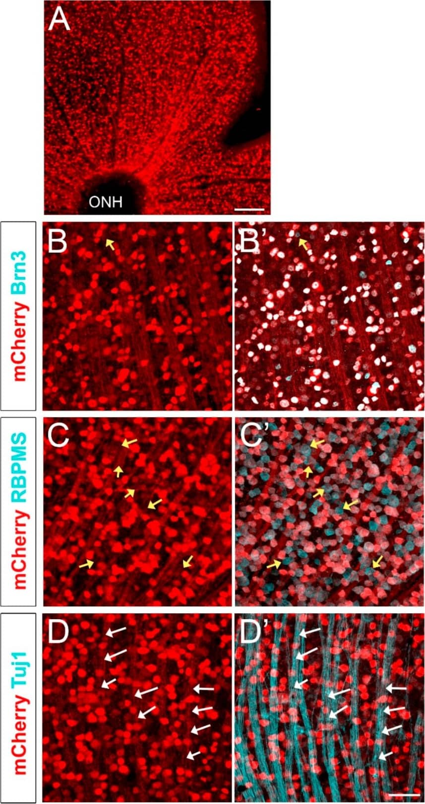 Immunocytochemistry/ Immunofluorescence: mCherry Antibody [NBP2-25157] - Brn3b-mCherry expression in the adult retina. (A) Flat-mounted retina labeled with anti-mCherry antibody. (B,B’) mCherry (red) & Brn3 (teal) colocalization. Yellow arrow indicates a Brn3+ mCherry- cell. (C,C’) mCherry (red) & RBPMS (teal) colocalization. Yellow arrows indicate RBPMS+ mCherry- cell bodies. (D,D’) mCherry (red) & Tuj1 (teal) colocalization. White arrows indicate Tuj1+ mCherry+ axons. (E–E’’’) Cross-section of an adult retina labeled with mCherry (red), RBPMS (gray), DAPI (blue), & Pax6 (green). All mCherry+ cells (white arrows) are RBPMS+. Amacrine cells are labeled with yellow stars & are mCherry- (Pax6+ RBPMS− mCherry− cells). Yellow arrowhead corresponds to an mCherry− RGC (RBPMS+ Pax6− mCherry− cell). ONH: Optic Nerve Head. ONL: Outer Nuclear Layer. INL: Inner Nuclear Layer. GCL: Ganglion Cell Layer. Scale bars: 300 microns in A, 50 microns in B–E’’’. Image collected & cropped by CiteAb from the following publication (//pubmed.ncbi.nlm.nih.gov/31197108), licensed under a CC-BY license. Not internally tested by Novus Biologicals.