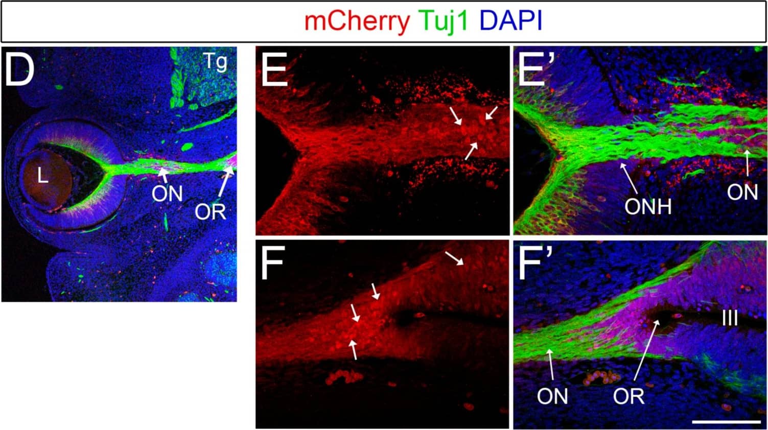 Immunocytochemistry/ Immunofluorescence: mCherry Antibody [NBP2-25157] - Brn3b-mCherry expression in other regions of the CNS. (A) Optic tracts at P0 visualized by mCherry staining (white arrows). (B,B’) Co-localization experiments with mCherry (red) & pan-Brn3 (green) antibodies at P0. (C,C’) Co-localization with mCherry (red) & Tuj1 (green) in the trigeminal ganglia at E13.5. Arrows indicate mCherry+ Tuj+ neurons. (D) Low magnification image of a horizontal E13.5 whole-head section. E–F’) White arrows indicate mCherry+ Tuj1- cells present in the optic stalk (E) & optic recess (F). Aq: Aqueduct. soSC: stratum opticum of the Superior Colliculus. SGS: Stratum Griseum Superficiale. Tg: Trigeminal ganglion. L: Lens. ONH: Optic Nerve Head. OR: optic recess. III: 3rd ventricle. Scale bar: 100 microns in C,C’, E,E’ & F,F’, 200 microns in B,B’, 300 microns in D, & 500 microns in A. Image collected & cropped by CiteAb from the following publication (//pubmed.ncbi.nlm.nih.gov/31197108), licensed under a CC-BY license. Not internally tested by Novus Biologicals.