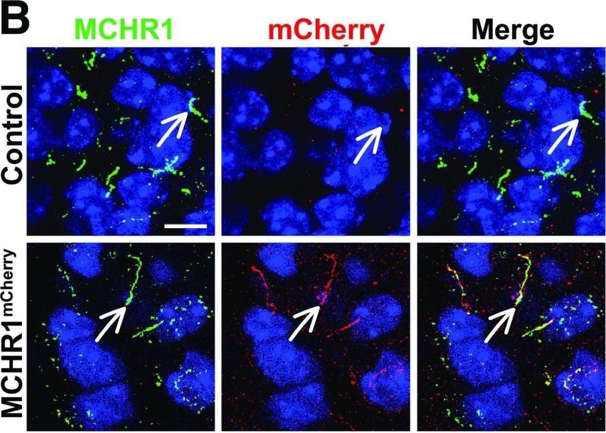 Immunocytochemistry/ Immunofluorescence mCherry Antibody - BSA Free
