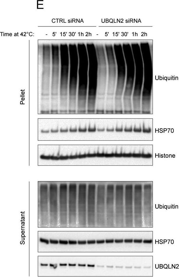 Heat Shock Generates Insoluble Ubiquitin-Positive Aggregates and Does Not Inactive Proteasomes, Related to Figure 1(A) UBQLN2 is not pelleted when cells are heat shocked post lysis. Cell lysates were incubated at 37 or 42C and then fractionated into soluble (S) and pellet (P) fraction. This indicates that UBQLN2 itself does not aggregate as a result of high temperature.(B) UBQLN2 levels are not upregulated in response to heat shock. HSP70 and GAPDH were used as a positive and negative controls, respectively.(C) Heat shock aggregates are insoluble in up to and including 1% SDS but are solubilized in 2% SDS. Blotting of soluble and pellet fractions with anti-ubiquitin and UQBLN2 antibodies confirmed dissolution of the aggregates in 2% SDS.(D) Proteasomes are active after heat shock. To confirm that proteasome activity was not affected by heat shock, we incubated U2OS and MEFs at the indicted temperatures for 2h. Cells were then harvested and cell lysates were incubated with the proteasome inhibitor MG132 or DMSO, followed by incubation with a fluorescent proteasome-activity probe, as indicated. The presence of fluorescently labeled beta-subunits at the same intensity under both heat stress and normal temperature, indicate that proteasome activity is not significantly affected by heat shock.(E) U2OS cells were treated with control or UBQLN2 siRNA and subjected to heat shock for the indicated times. Analysis of the pellet fraction revealed that insoluble ubiquitylated aggregates are generated within 5 min of heat shock, but that depletion of UBQLN2 does not noticeably alter the accumulation of these aggregates at any of the indicated time points. Image collected and cropped by CiteAb from the following open publication (//pubmed.ncbi.nlm.nih.gov/27477512), licensed under a CC-BY license. Not internally tested by Novus Biologicals.