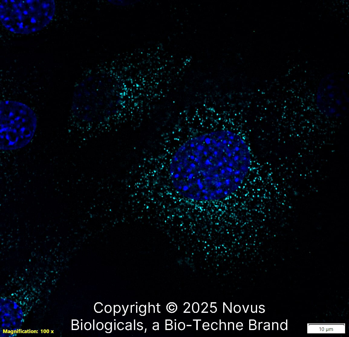 LAMP-1/CD107a (H4A3) was detected in immersion fixed NIH-3T3 Mouse fibroblast cell line using Mouse anti-LAMP-1/CD107a (H4A3) Protein-G purified Monoclonal Antibody conjugated to Alexa Fluor® 647 (Catalog # NBP2-25183AF647) (light blue) at 2 µg/mL overnight at 4C. Cells were counterstained with DAPI (blue). Cells were imaged using a 100X objective and digitally deconvolved.  
