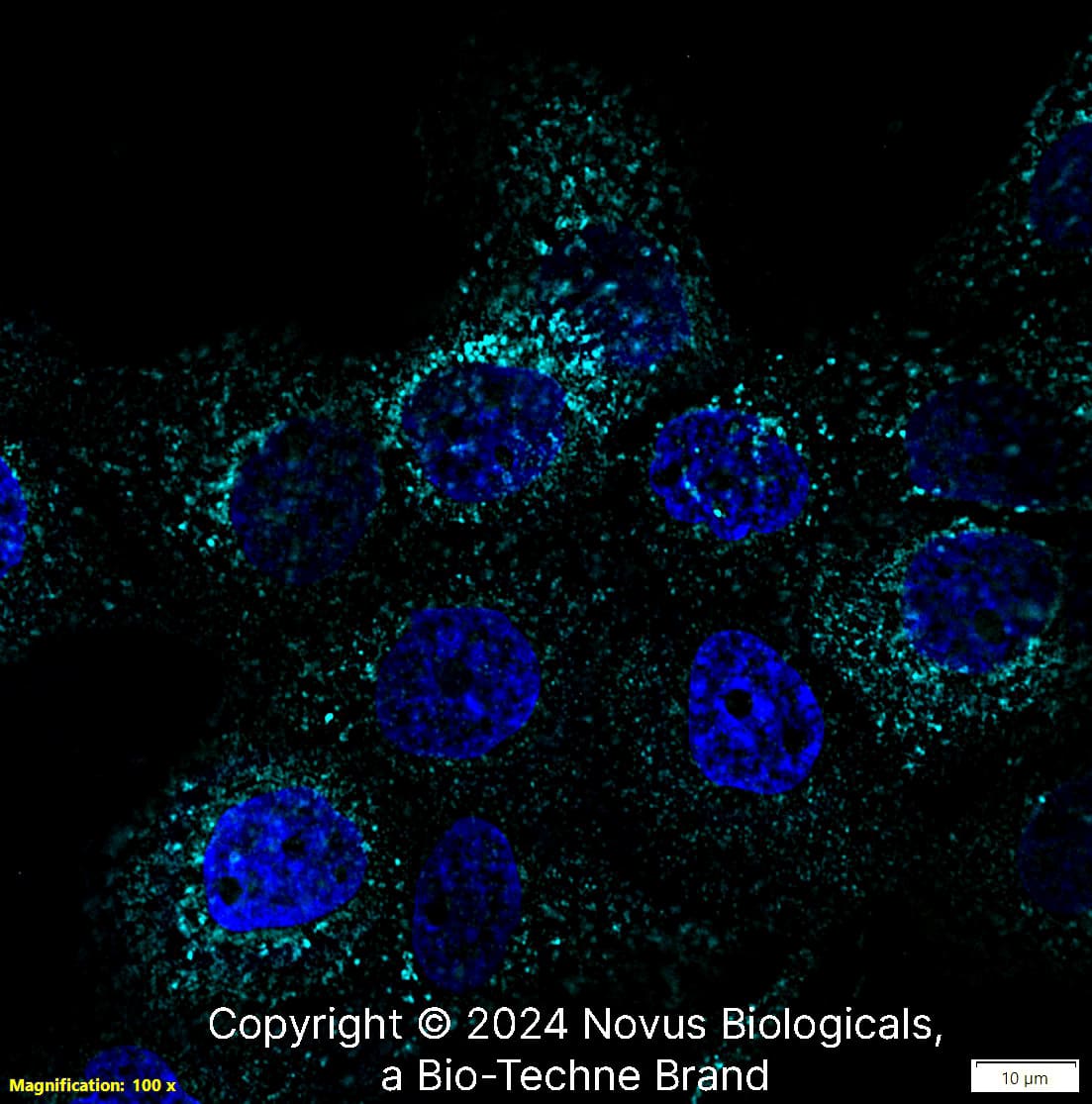 LAMP-1/CD107a (H4A3) was detected in immersion fixed A431 human skin carcinoma cell line using Mouse anti- LAMP-1/CD107a (H4A3) Protein-G purified Monoclonal Antibody conjugated to Alexa Fluor® 647 (Catalog # NBP2-25183AF647) (light blue) at 10 µg/mL overnight at 4C. Cells were counterstained with DAPI (blue). Cells were imaged using a 100X objective and digitally deconvolved.  