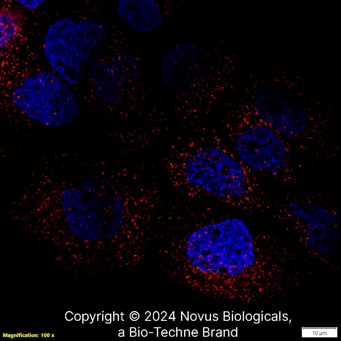 LAMP-1/CD107a (H4A3) was detected in immersion fixed A431 human skin carcinoma cell line using Mouse anti- LAMP-1/CD107a (H4A3) Protein-G purified Monoclonal Antibody conjugated to DyLight 550 (Catalog # NBP2-25183R) (red) at 5 µg/mL overnight at 4C. Cells were counterstained with DAPI (blue). Cells were imaged using a 100X objective and digitally deconvolved.  