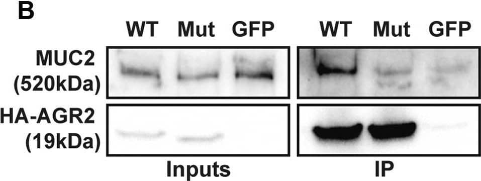 AGR2 H117Y has a reduced ability to interact with MUC2 and regulate ER stress in vitro. (A) HEK293T cells were transfected with equal amounts of WT or H117Y mutant (Mut) HA-tagged AGR2 (HA-AGR2) and blotted for AGR2 or  beta -actin as a loading control. Mutant HA-AGR2 consistently showed lower expression when examined by Western blot. Data are representative of 3 independent experiments. (B and right panel of C) Mutant AGR2 was transfected at double the amount compared with WT plasmid to obtain the same level, or higher, of mutant AGR2 protein as WT. (B) LS174T cells were transfected with WT or H117Y mutant HA-AGR2 or Green Fluorescent Protein (GFP) as a transfection control. Transfected AGR2 was immunoprecipitated using anti-HA beads, and immunoprecipitates were blotted for MUC2 (clone CCP58) and HA-tag. (C) Immunoblots of the lysates of HEK293T cells overexpressing WT or Mut AGR2 or GFP and stressed with tunicamycin (Tun) 48 hours after transfection. Left: Data from cells transfected with equal amounts of WT or Mut (1×) plasmid. Right: Results in which twice (2×) the amount of mutant AGR2 plasmid was transfected than for WT. Blots were stained with antibodies against BiP (clone C50B12), AGR2 (clone D9V2F), HA (clone C29F4), and  beta -actin. Experiment was repeated 3 independent times in HEK293T. Image collected and cropped by CiteAb from the following open publication (//pubmed.ncbi.nlm.nih.gov/34237462), licensed under a CC-BY license. Not internally tested by Novus Biologicals.