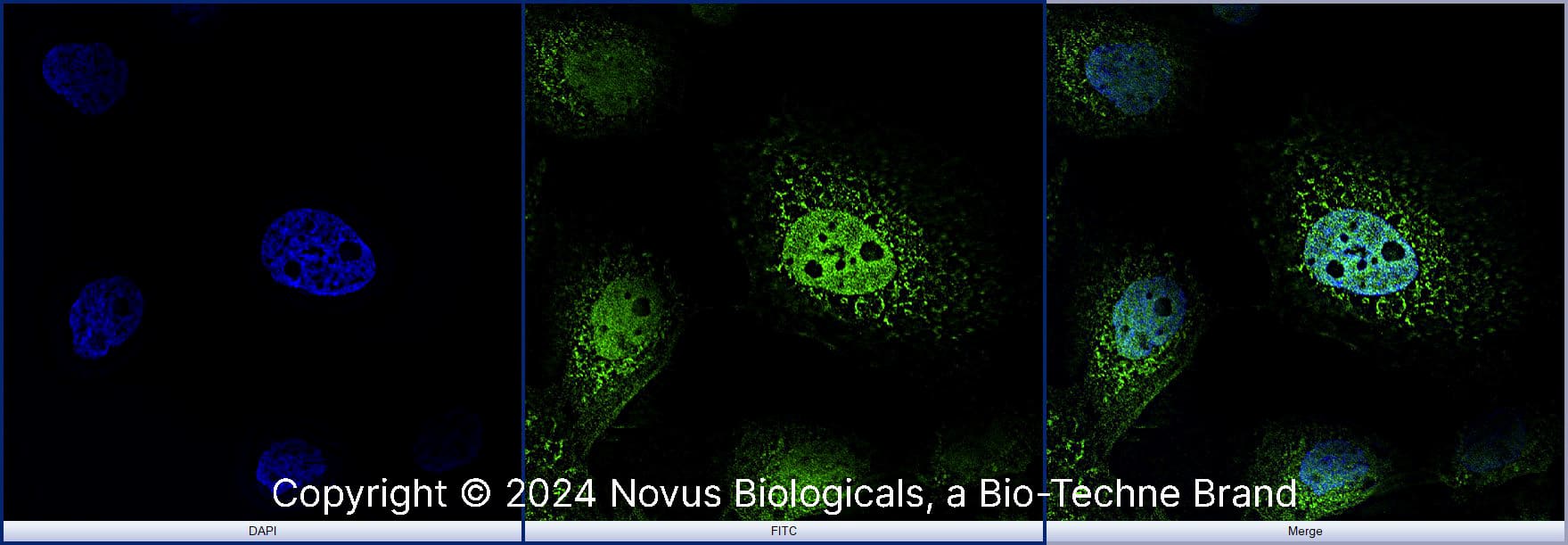 STAT6 (177C322.1) was detected in immersion fixed A431 human skin carcinoma cell line using Mouse anti- STAT6 (177C322.1) Protein-G purified Monoclonal Antibody conjugated to Alexa Fluor® 488 (Catalog # NBP2-25241AF488) (green) at 10 µg/mL overnight at 4C. Cells were counterstained with DAPI (blue). Cells were imaged using a 100X objective and digitally deconvolved.  