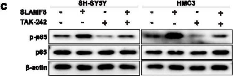 (a) The overexpression of SLAMF8 in AD cell models increased the levels of TLR4/NF-kappa B signaling-related markers (TLR4, p-I kappa B alpha /I kappa B alpha  ratio) and the phospho-p65/p65 ratio, as confirmed by Western blot. Quantification of the Western blot results was performed and normalized against  beta -actin (n = 3) (a1). (b) Conversely, knockdown of SLAMF8 produced the opposite effect and the data were quantified and normalized to  beta -actin (n = 3). (b1) The TLR4/NF-kappa B signaling inhibitor TAK-242 suppressed TLR4 expression (c,c1) and mitigated the increase in ROS (d,e) and neuroinflammation (f) caused by SLAMF8 overexpression in AD cell models. Data are presented as mean +/- standard deviation. One-way ANOVA with Tukey’s post hoc test was used for multiple group comparisons, and a paired t-test was used for comparisons between two groups. “*