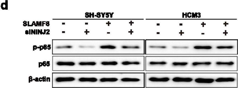 (a,b) Knockdown of NINJ2 significantly abolished SLAMF8-induced oxidative stress, reduced ROS levels (DCF and MitoSOX Red), and decreased NOX2 and NOX4 expression in A beta 1-42-treated SH-SY5Y cells. (c) Similarly, knockdown of NINJ2 significantly reduced the SLAMF8-treated neuroinflammation in LPS-treated HMC3 cells. (d) In SLAMF8-stably overexpressing AD cell models, transient knockdown of NINJ2 with siNINJ2 for 48 h significantly abolished SLAMF8-induced p65 phosphorylation in the TLR4/NF-kappa B signaling pathway. Data are presented as mean +/- standard deviation. One-way ANOVA with Tukey’s post hoc test was used for multiple group comparisons, and a paired t-test was used for comparisons between two groups. “*