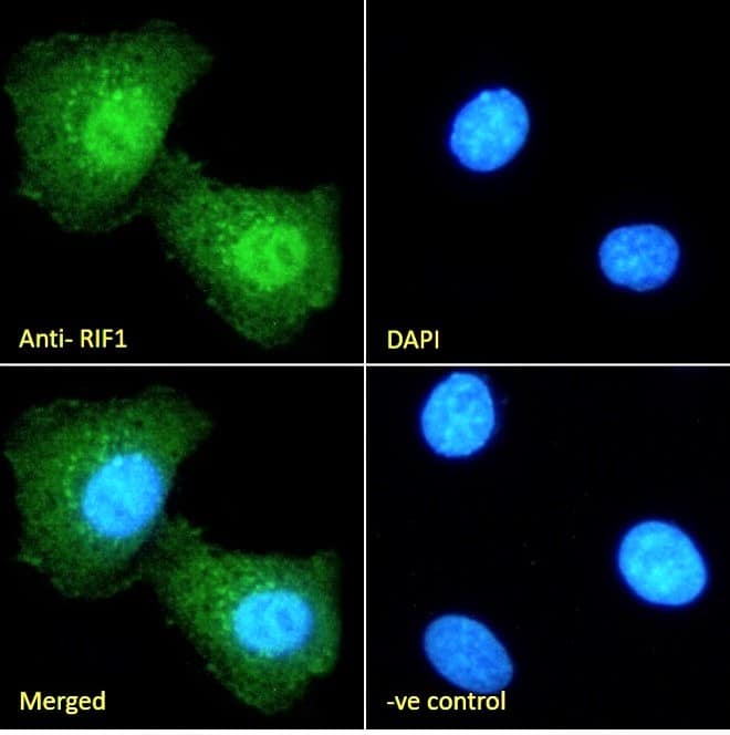 Immunocytochemistry/Immunofluorescence: Rif1 Antibody [NBP2-26129] - Immunofluorescence analysis of paraformaldehyde fixed HEK293 cells, permeabilized with 0.15% Triton. Primary incubation 1hr (10ug/ml) followed by Alexa Fluor 488 secondary antibody (2ug/ml), showing nuclear and some cytoplasmic staining. The nuclear stain is DAPI (blue). Negative control: Unimmunized goat IgG (10ug/ml) followed by Alexa Fluor 488 secondary antibody (2ug/ml).