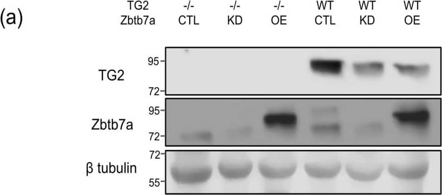 Manipulating the expression of Zbtb7a in WT and TG2−/− astrocytes differentially impacts morphology. (a) Immunoblots showing knockdown (KD) or overexpression (OE) of Zbtb7a, compared to control (CTL), in WT and TG2−/− astrocytes. Since the Zbtb7a OE virus encodes human Zbtb7a, the Zbtb7a bands in these samples migrated slightly faster than bands in the CTL and KD samples from mouse astrocytes. (b) Representative images of the astrocyte GFAP network in the different conditions (scale bar = 20 um) and (c) Quantitation of GFAP network area (n = 34–50 astrocytes per condition from two independent biological replicates, Two-way ANOVA * p < 0.05, *** p < 0.001). Image collected and cropped by CiteAb from the following open publication (//pubmed.ncbi.nlm.nih.gov/37047031), licensed under a CC-BY license. Not internally tested by Novus Biologicals.