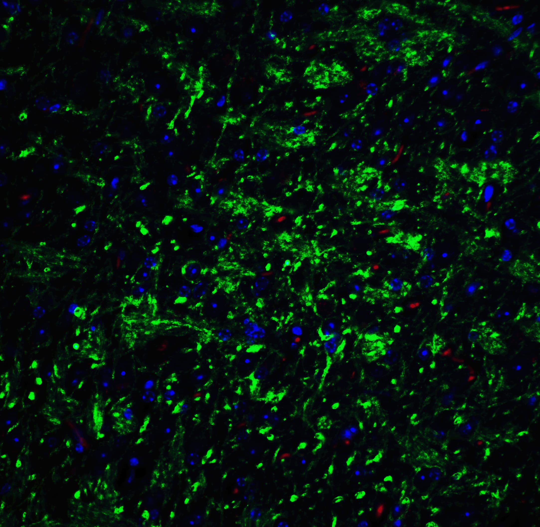 Immunocytochemistry/ Immunofluorescence: Cadherin-13 Antibody - BSA Free [NBP2-26611] - Immunofluorescence of T cadherin in mouse brain tissue with T cadherin Antibody at 20 ug/mL. Green: Cadherin-13 antibody   Red: Phylloidin staining Blue: DAPI staining