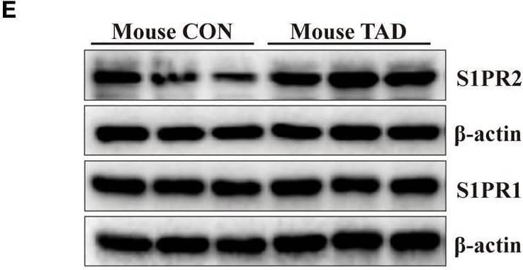 Western Blot S1P2/EDG-5/S1PR2 Antibody - BSA Free