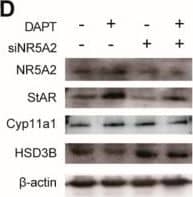 Effects of NR5A2 knockdown on progesterone biosynthesis. (A) gene expression of NR5A2 after siRNA transfection; (B) effects of NR5A2 knockdown on progesterone secretion; (C) gene expression of key factors (StAR, Cyp11a1, HSD3B, and NPC1) involved in progesterone biosynthesis; (D,E) protein expression of NR5A2, StAR, Cyp11a1, and HSD3B. Primary pGCs were transfected with NR5A2 siRNA (siNR5A2) or scramble siRNA (siNC). Six hours later, the medium was changed to fresh medium with DMSO or DAPT, followed by further culture for 48 h. * means significant difference at p < 0.05. Image collected and cropped by CiteAb from the following open publication (//pubmed.ncbi.nlm.nih.gov/31978970), licensed under a CC-BY license. Not internally tested by Novus Biologicals.