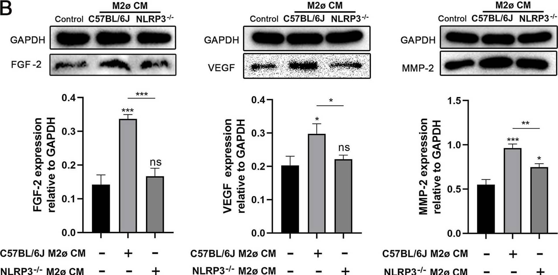 NLRP3 in macrophages affects the activity of myofibroblasts (A) The protein expression levels of FGF-2, VEGF, and MMP-2 in wild-type myofibroblasts treated with wild-type M1ø CM or NLRP3−/− M1ø CM. B The protein expression levels of FGF-2, VEGF, and MMP-2 in wild-type myofibroblasts treated with wild-type M2ø CM or NLRP3−/− M2ø CM. GAPDH was used as a loading control. Grayscale values were measured using ImageJ software. Results are expressed as mean +/- SD and were analyzed by one-way ANOVA followed by Tukey’s multiple comparisons test (n = 5). Statistical significance is indicated as follows: *P < 0.05, **P < 0.01, ***P < 0.001. ns, not significant Image collected and cropped by CiteAb from the following open publication (//pubmed.ncbi.nlm.nih.gov/39881348), licensed under a CC-BY license. Not internally tested by Novus Biologicals.