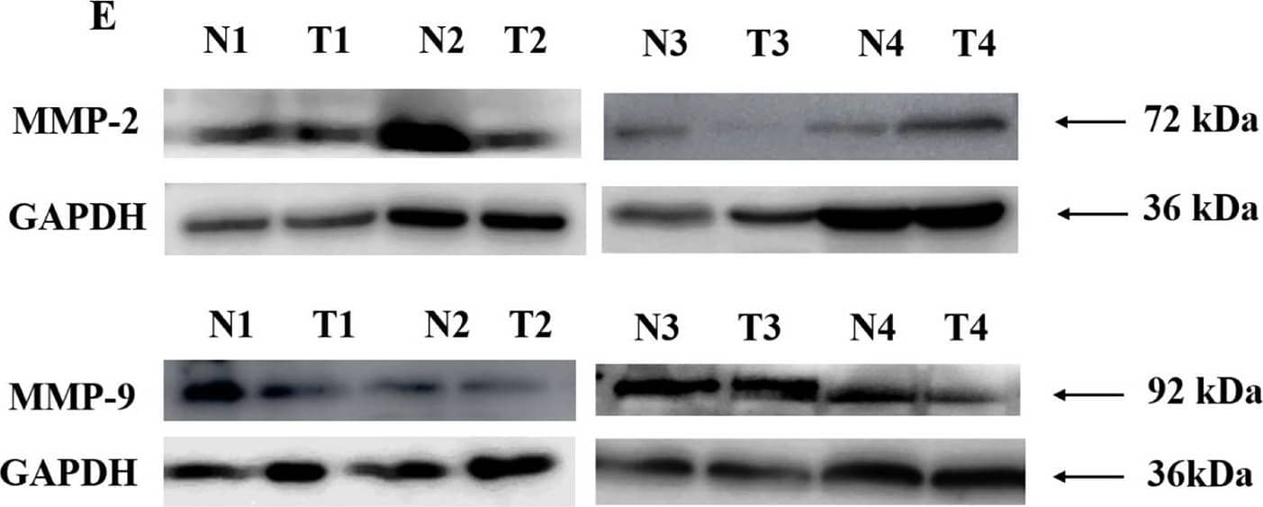 (A–D) Gene expression of metastasis markers in breast cancer patients (A) MMP-2, (B) MMP-9 in local cohort (C) MMP-2, (D) MMP-9 in TCGA cohort and (E–G) Protein expression of metastasis markers (E) Representative blots in adjacent normal (N) and tumor (T) tissues, (F) Densitometric analysis of MMP-2 and (G) MMP-9 levels in adjacent normal and tumor tissues. Image collected and cropped by CiteAb from the following open publication (//pubmed.ncbi.nlm.nih.gov/36309544), licensed under a CC-BY license. Not internally tested by Novus Biologicals.
