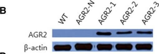 Western Blot: AG-2/AGR2 Antibody [NBP2-27393] - Alterations of tumor-associated phenotypes by overexpression of AGR2 in SNU-869 cells. A. AGR2 expression in the SNU-869 stable transfectants was verified by real-time RT-PCR. The AGR2 transcript level was normalized against that of GAPDH. Results shown are means ± standard deviations of (1/2)CT of target - CT of GAPDH of three experiments. B. AGR2 protein expression in the SNU-869 stable transfectants was detected by western blot analysis with  beta -actin as a loading control. The result shown is a representative of three experiments. C. Viability of the SNU-869 stable transfectants was measured by the MTT assay. Results shown are means ± standard deviations of three experiments (ANOVA P = 0.008; post hoc analysis by Bonferroni testing: AGR2-2 vs. AGR2-N, P = 0.013). D. The effect of AGR2 overexpression on cell proliferation. Pulsed BrdU incorporation into the SNU-869 stable transfectants was measured by flow cytometry. Percentage of BrdU-positive cells was shown in mean ± standard deviation of four experiments (ANOVA P = 0.053; post hoc analysis by Bonferroni testing: AGR2-2 vs. AGR2-N, P = 0.027). Results shown are representatives of four experiments. E. The effect of AGR2 overexpression on tumor cell invasion of SNU-869 cells. The numbers of invading cells in the transwell invasion assay were determined for SNU-869 stable transfectants. Results shown are means ± standard deviations of three experiments (ANOVA P = 0.003; post hoc analysis by Bonferroni testing: AGR2-2 vs. AGR2-N, P = 0.026). Image collected & cropped by CiteAb from the following publication (//bmccancer.biomedcentral.com/articles/10.1186/1471-2407-14-804), licensed under a CC-BY license. Not internally tested by Novus Biologicals.