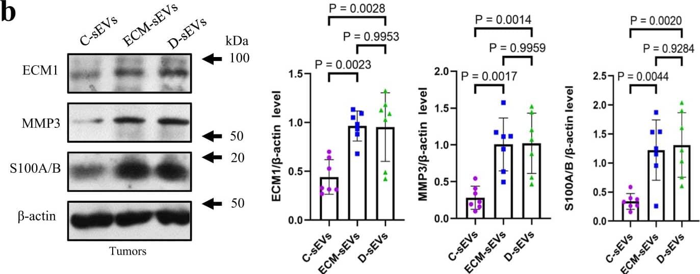 ECM1 in the sEVs plays a role in enhancing BC growth and metastasis.a A schematic diagram showing the sEVs treatment protocol. b Protein expressions of ECM1, MMP3 and S100A/B in the tumors of E0771-bearing B6/J-Rab27a-Cas9-KO mice after C-sEVs, D-sEVs or ECM-sEVs treatments. c Tumors, d tumor size, e tumor weight and f lung metastasis of the E0771-bearing B6/J-Rab27a-Cas9-KO mice after sEVs treatments. Mouse tumor sizes are presented as the mean +/- SEM, other data are presented as mean +/- SD; one-way ANOVA with Tukey’s multiple comparison test for (b, d, e); n = 7 mice in each group, p values are indicated in graphs. Rab27aKO, B6/J-Rab27a-Cas9-KO mice; C-sEVs, circulating sEVs in CD-fed C57BL/6 mice; D-sEVs, circulating sEVs in high-fat-diet induced obesity C57BL/6 mice; ECM-sEVs, ECM1 construct-loaded C-sEVs; ECM1, extracellular matrix protein 1; MMP3, matrix metallopeptidase 3. Source data are provided as a Source Data file. Image collected and cropped by CiteAb from the following open publication (//www.nature.com/articles/s41467-024-45995-5), licensed under a CC-BY license. Not internally tested by Novus Biologicals.