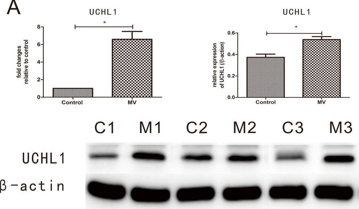 qRT–PCR and western blot analysis. A–C The top bar graph presents the mRNA/protein levels (Uchl1/UCHL1, Tmprss13/TMPRSS13, and Cst3/CST3) in the diaphragm for the MV and control groups. The mRNA expression levels of three genes measured by quantitative real-time PCR were normalized with respect to  beta -actin and are expressed as fold changes relative to the control levels. The protein expression levels were also normalized with respect to  beta -actin. The bottom panel presents the western blotting results for UCHL1, TMPRSS13, CST3, and  beta -ACTIN protein levels in the diaphragm for the MV and control groups. The data are presented as the mean +/- SD (n=6); “*