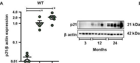 Western Blot p21/CIP1/CDKN1A Antibody (WA-1)
