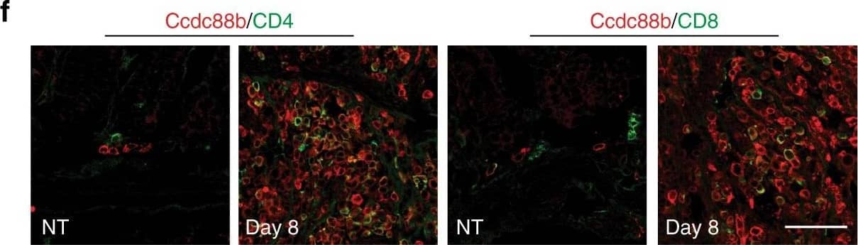 Immunohistochemistry-Frozen: CD8 Antibody [NBP2-29475] - Mouse Ccdc88b expression in colon during DSS-induced colitis. Wild type (WT) mice were either not treated (NT) or given 3% DSS for 5 days followed by 3 days of water. aCcdc88b mRNA expression in distal colons of NT (n = 3) or DSS-treated WT mice (n = 3 for each time point) at the indicated days. Data represent expression relative to hprt±SEM (n = 3). *P < 0.05, **P < 0.01 (two-tailed Student’s t-test) & are representative of one experiment. b Representative immunoblots for Ccdc88b protein detected in extracts from distal colons from NT or DSS-treated WT & Ccdc88Bmut mutant mice at indicated time points, & densitometric quantification of Ccdc88b immunoblot normalized to  beta -actin±SEM (n = 3) (representative of one of two independent experiments); **P < 0.01 (two-tailed Student’s t-test). c Representative confocal microscopy images of tissue sections from colon of NT or DSS-treated mice at indicated times, & stained with antibodies against Ccdc88b (red), CD45 (green), & E-Cadherin (purple) & nuclei staining DAPI (blue). Scale bars, 100 μm. d Representative FACS plots & quantification of lamina propria cells stained for CD45 & for Ccdc88b antibodies for NT (n = 3) & DSS-treated WT mice (n = 4 for each time point) at indicated time points, data are representative of one experiment. e Representative confocal microscopy images of tissue sections from colon of NT or DSS-treated mice at day 8, & stained for Ccdc88b (red), CD3 (green) & CD11b (green); nuclei are stained with DAPI (blue). Scale bars, 100 μm. f same as in e for Ccdc88b (red), CD4 (green) & CD8 (green). Scale bars, 100 μm Image collected & cropped by CiteAb from the following publication (//www.nature.com/articles/s41467-017-01381-y), licensed under a CC-BY license. Not internally tested by Novus Biologicals.