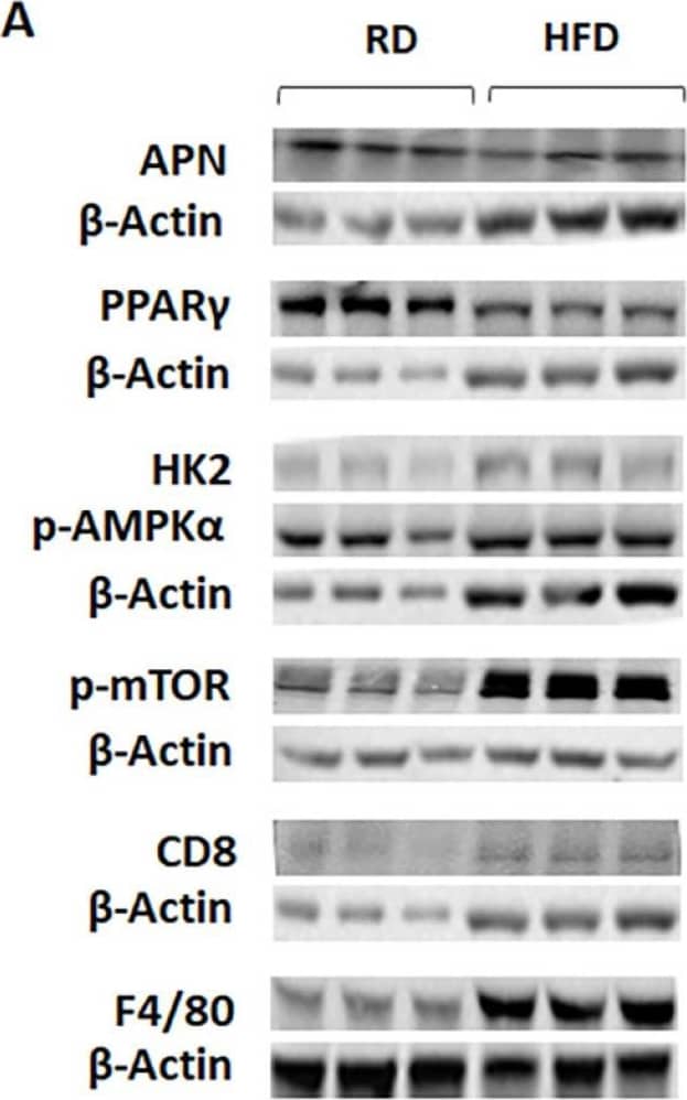 Western Blot CD8 Antibody