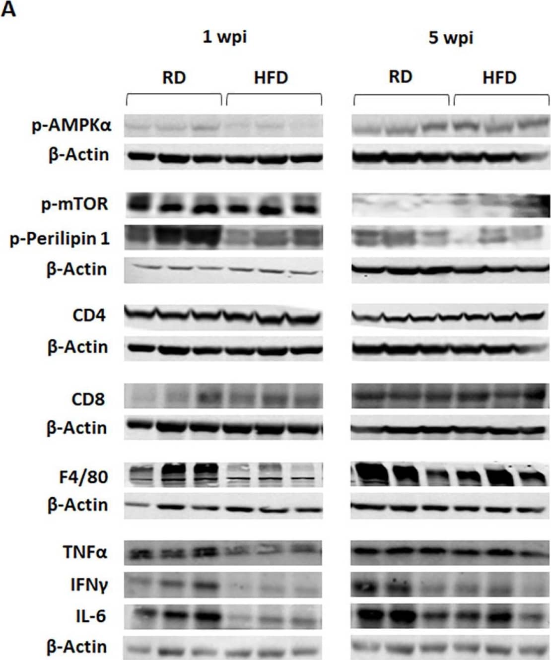 Western Blot CD8 Antibody