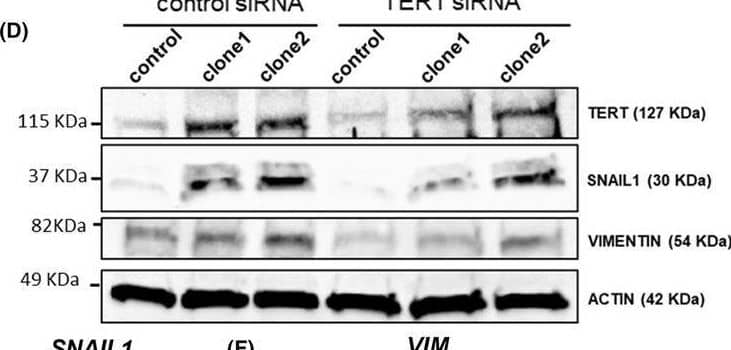 microRNA‐196a (miR‐196a) effects are mediated by TERT. (A–D) TERT siRNA interference reduces the expression of epithelial‐to‐mesenchymal transition markers (EMT) in miR‐196a overexpressing OE33 clones both at mRNA and protein levels. Cells were transfected using Lipofectamine 2000 with TERT siRNA or control siRNA (ctrl siRNA) and gene expression was analyzed after 48 h by qPCR (A–C). Protein expression in these cells was analyzed by western blot (D). (E–G) Reduction of miR‐196a‐mediated increase in the expression of EMT markers, both at mRNA and protein levels, upon TERT inhibition. Control cells and OE33 clones overexpressing miR‐196a were treated with 20 μm of BIBR1532 or DMSO as control for 18 h, and gene and protein expression were analyzed. (H) Reduction of miR‐196a‐mediated increase in cell motility upon TERT inhibition. Control cells and OE33 clones overexpressing miR‐196a were treated with 20 μm of BIBR1532 or DMSO as control for 18 h, and cell motility was analyzed by wound‐healing assay. Data are mean + standard error of the mean of three independent experiments. **P < 0.01 and ***P < 0.001 for analysis of variance (ANOVA), plus Bonferroni post‐test. ns, not significant. Image collected and cropped by CiteAb from the following open publication (//pubmed.ncbi.nlm.nih.gov/40955778), licensed under a CC-BY license. Not internally tested by Novus Biologicals.
