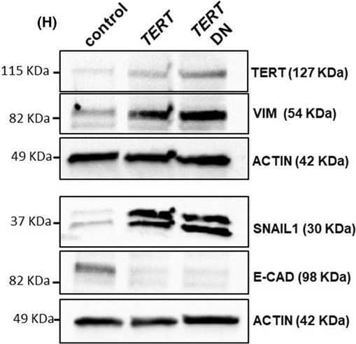 microRNA‐196a (miR‐196a) up‐regulates TERT expression, and TERT increases NF kappa B activity and produces epithelial‐to‐mesenchymal transition (EMT) in Esophageal Adenocarcinoma cells in a telomere lengthening‐independent manner. (A) Expression of TERT, the main component of the telomerase complex, by qPCR in control and OE33 mir196a overexpressing cells. (B) TERT expression in OE33 control and OE33 clones stably overexpressing TERT or a dominant negative form of TERT (TERT DN). (C) Phenotype switch in OE33 TERT and TER‐DN overexpressing clones. (D) TERT overexpression increases NF kappa B signaling activity. Control or OE33 clones stably overexpressing TERT or TERT DN were transfected with a plasmid containing 4xNF kappa B response elements controlling the expression of downstream luciferase gene. After 48 h, protein extract was obtained, and luciferase activity was quantified using the Dual‐Glo Luciferase Assay System. (E–H) qPCR and western blots of control and OE33 TERT and TER‐DN overexpressing clones showing the expression of EMT markers at both mRNA and protein levels. Scale bar, 100 μm. Data are mean + standard error of the mean of three independent experiments. **P < 0.01 and ***P < 0.001 for analysis of variance (ANOVA), plus Bonferroni post‐test. Image collected and cropped by CiteAb from the following open publication (//pubmed.ncbi.nlm.nih.gov/40955778), licensed under a CC-BY license. Not internally tested by Novus Biologicals.