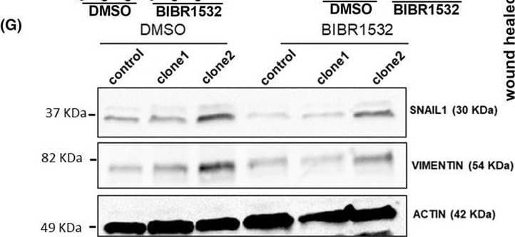 microRNA‐196a (miR‐196a) effects are mediated by TERT. (A–D) TERT siRNA interference reduces the expression of epithelial‐to‐mesenchymal transition markers (EMT) in miR‐196a overexpressing OE33 clones both at mRNA and protein levels. Cells were transfected using Lipofectamine 2000 with TERT siRNA or control siRNA (ctrl siRNA) and gene expression was analyzed after 48 h by qPCR (A–C). Protein expression in these cells was analyzed by western blot (D). (E–G) Reduction of miR‐196a‐mediated increase in the expression of EMT markers, both at mRNA and protein levels, upon TERT inhibition. Control cells and OE33 clones overexpressing miR‐196a were treated with 20 μm of BIBR1532 or DMSO as control for 18 h, and gene and protein expression were analyzed. (H) Reduction of miR‐196a‐mediated increase in cell motility upon TERT inhibition. Control cells and OE33 clones overexpressing miR‐196a were treated with 20 μm of BIBR1532 or DMSO as control for 18 h, and cell motility was analyzed by wound‐healing assay. Data are mean + standard error of the mean of three independent experiments. **P < 0.01 and ***P < 0.001 for analysis of variance (ANOVA), plus Bonferroni post‐test. ns, not significant. Image collected and cropped by CiteAb from the following open publication (//pubmed.ncbi.nlm.nih.gov/40955778), licensed under a CC-BY license. Not internally tested by Novus Biologicals.
