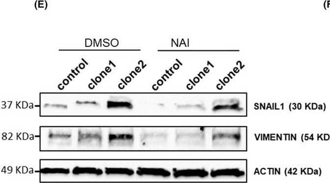 microRNA‐196a (miR‐196a) effects are mediated by the NF kappa B signaling pathway. (A) Pathway enrichment meta‐analysis of miRTarBase predicted targets for miR‐196a. (B) Gene expression of the miR‐196a validated target NFKBIA in control and OE33 miR‐196a overexpressing clones. (C) Activity of the NF kappa B pathway in control and OE33 miR‐196a clones. Cells were transfected with a plasmid containing 4xNF kappa B response elements controlling the expression of the downstream luciferase gene. After 48 h, protein extract was obtained and luciferase activity was quantified using the Dual‐Glo Luciferase Assay System. (D) Reversion of the mesenchymal phenotype of control and OE33 miR‐196a overexpressing clones after inhibition of NF kappa B. Cells were treated with 10 μm of NAI or DMSO as control for 18 h. Scale bar, 100 μm. (E) Western Blot images showing the inhibition of the increase in both SNAIL1 and VIMENTIN protein levels, and in cell motility (F) of control and OE33 miR‐196a overexpressing clones after inhibition of NF kappa B signaling using 10 μm of NAI or DMSO as control for 18 h. Data are mean + standard error of the mean of three independent experiments. **P < 0.01 and ***P < 0.001 for analysis of variance (ANOVA), plus Bonferroni post‐test. ns, not significant. Image collected and cropped by CiteAb from the following open publication (//pubmed.ncbi.nlm.nih.gov/40955778), licensed under a CC-BY license. Not internally tested by Novus Biologicals.