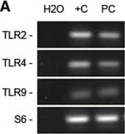 Embryonic ENS culture neurons express TLR2/4/9. a Agarose gel showing specific products of real-time PCR for the assayed genes in ENS culture (PC); water was used as a no-template control (H2O) and rat colon cDNA as positive control (+C). b TLR relative expression in ENS culture in basal conditions (n = 8). c Localisation of TLR in ENS culture ganglia. B-tubulin III was used instead of HuC/D as neuronal marker for colocalisation with TLR9 due to antibody detection incompatibilities. White arrows point to neuronal somas. Scale bars: 25 μm Image collected and cropped by CiteAb from the following open publication (//pubmed.ncbi.nlm.nih.gov/27538577), licensed under a CC-BY license. Not internally tested by Novus Biologicals.