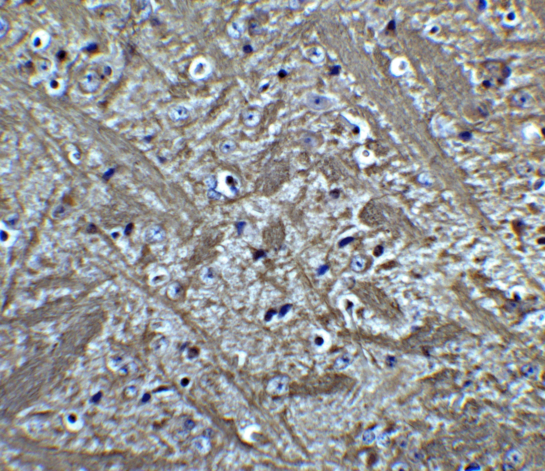 Immunohistochemistry: Bcl-2 Antibody - BSA Free [NBP2-30108] - Figure 6 Immunohistochemistry Validation of Bcl-2 in Mouse Brain Tissue  Immunohistochemical analysis of paraffin-embedded Mouse Brain Tissue using anti-Bcl-2 antibody  at 5 u/ml. Tissue was fixed with formaldehyde and blocked with 10% serum for 1 h at RT; antigen retrieval was by heat mediation with a citrate buffer (pH6). Samples were incubated with primary antibody overnight at 4;C. A goat anti-rabbit IgG H&L (HRP) at 1/250 was used as secondary. Counter stained with Hematoxylin.