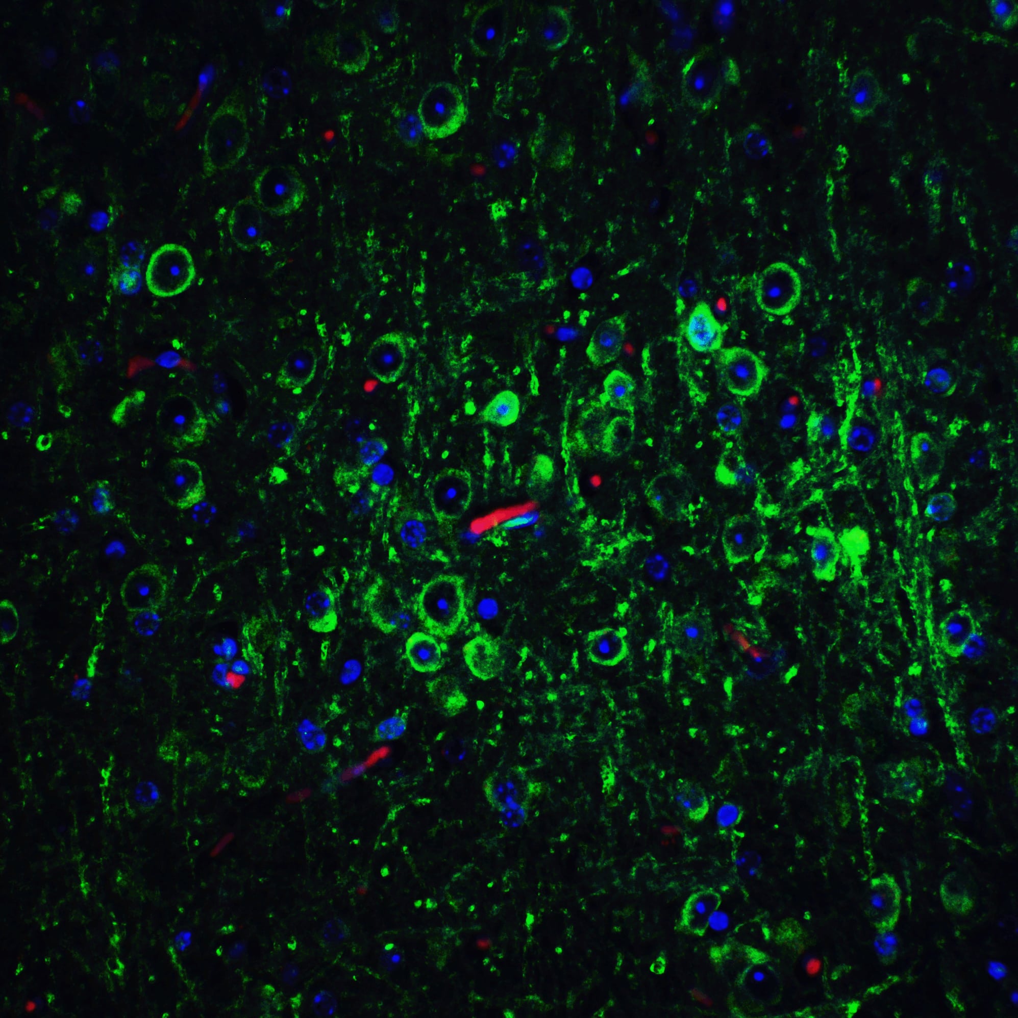 <b>Independent Antibodies Validation. </b>Immunocytochemistry/ Immunofluorescence: Bcl-2 Antibody - BSA Free [NBP2-30108] - Figure 7 Immunofluorescence Validation of Bcl-2 in Mouse Brain TissueImmunofluorescent analysis of 4% paraformaldehyde-fixed Mouse Brain Tissue labeling Bcl-2 with  at 20 u/mL, followed by goat anti-rabbit IgG secondary antibody at 1/500 dilution (green). 