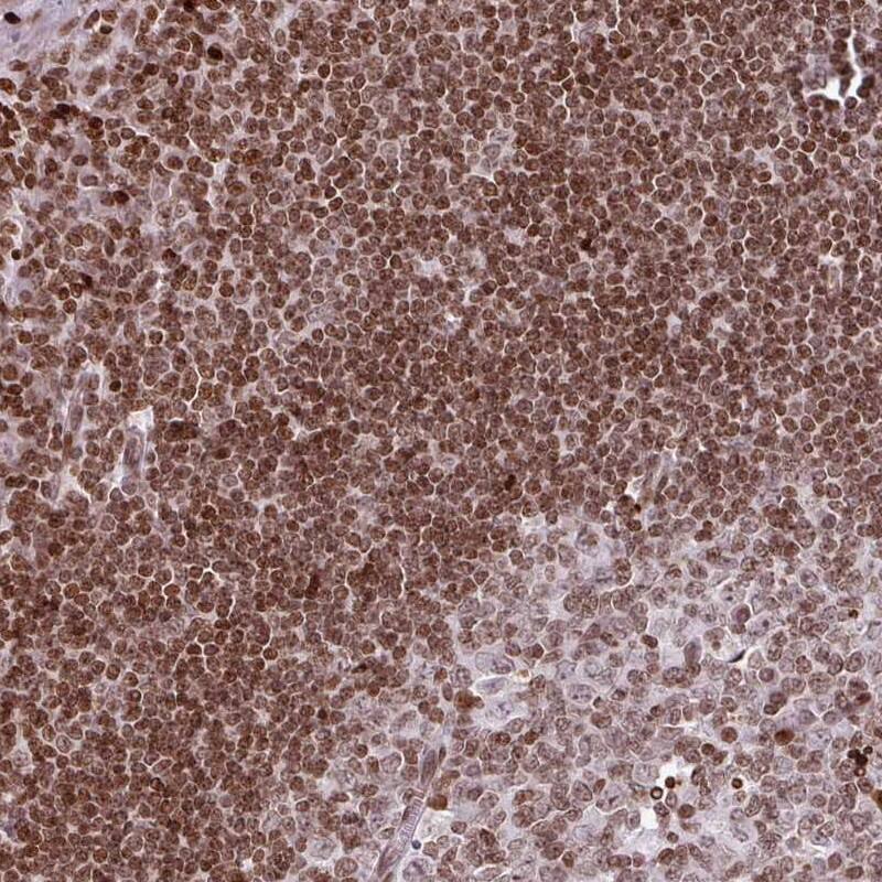 Immunohistochemistry-Paraffin RASL11A Antibody - BSA Free