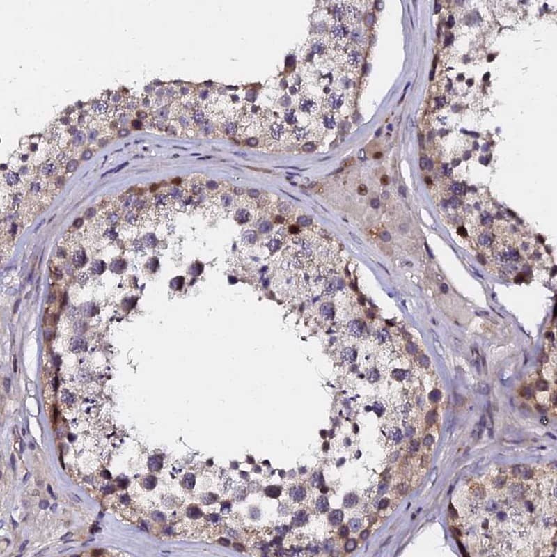 Staining of human testis shows nuclear and cytoplasmic positivity in cells in seminiferous ducts.