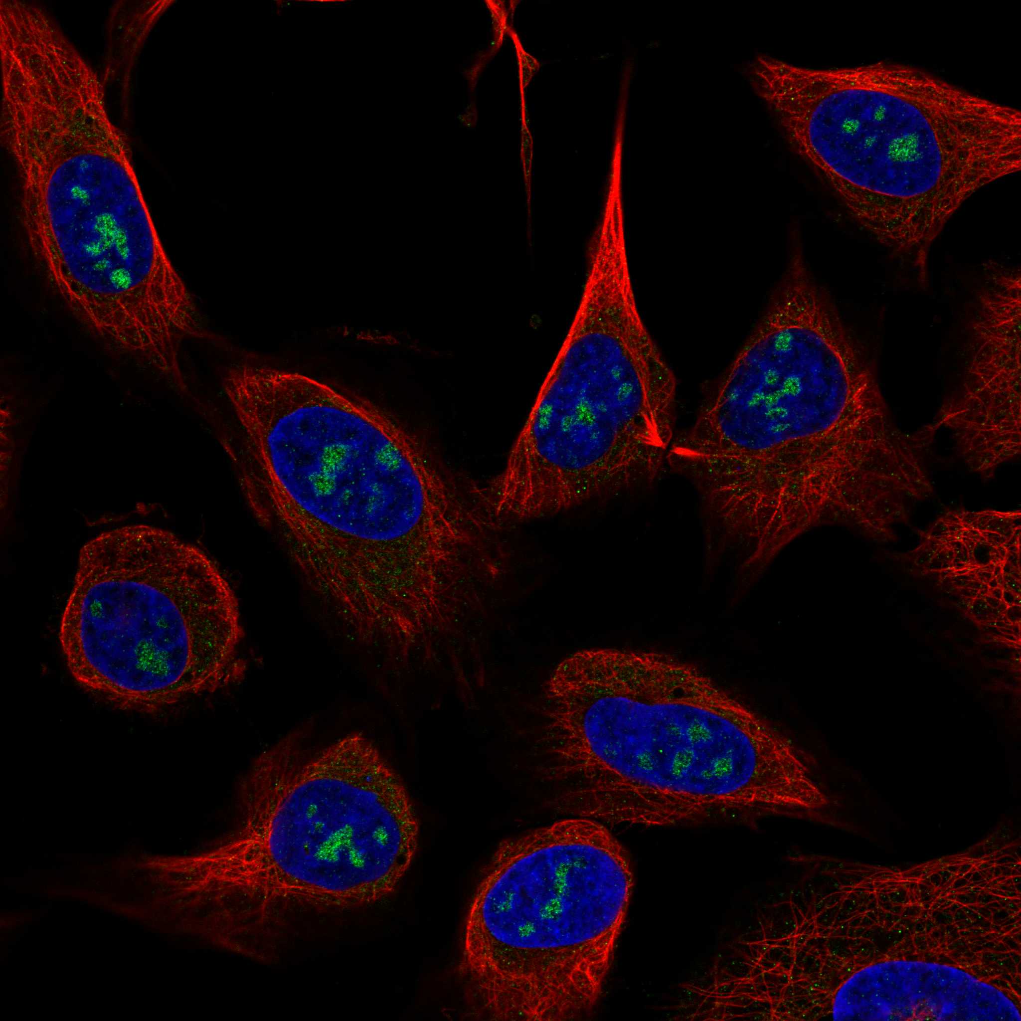 Staining of U-2 OS cells, showing specific staining in nucleoli in green. Microtubule- and nuclear probes are visualized in red and blue, respectively (where available).