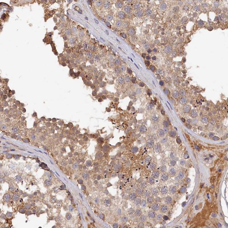 Immunohistochemistry-Paraffin MGC4172 Antibody - BSA Free