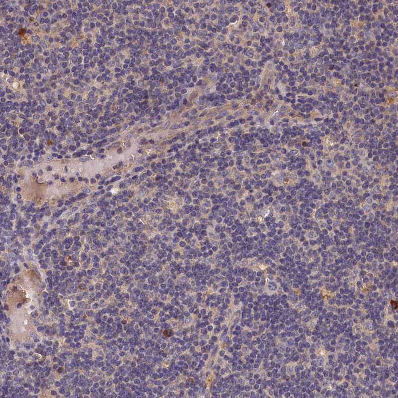 Staining of human lymph node shows very weak positivity in non-germinal center cells as expected.