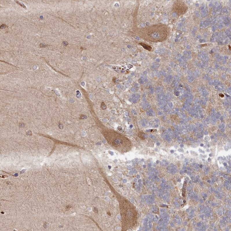 Staining of human cerebellum shows moderate cytoplasmic positivity in Purkinje cells.