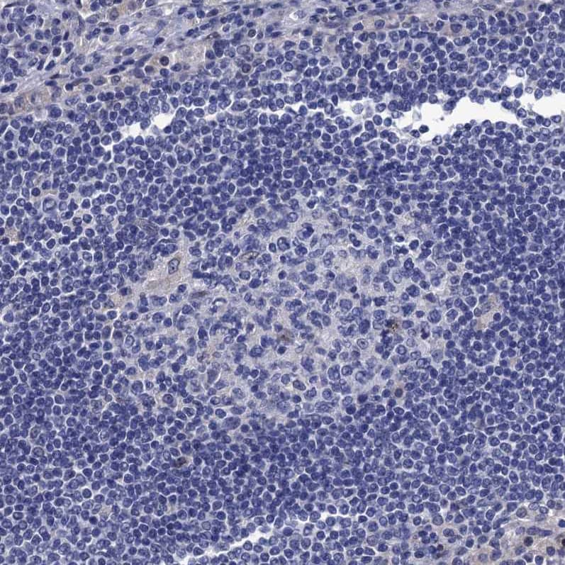 Staining of human lymph node shows no positivity in non-germinal center cells as expected.