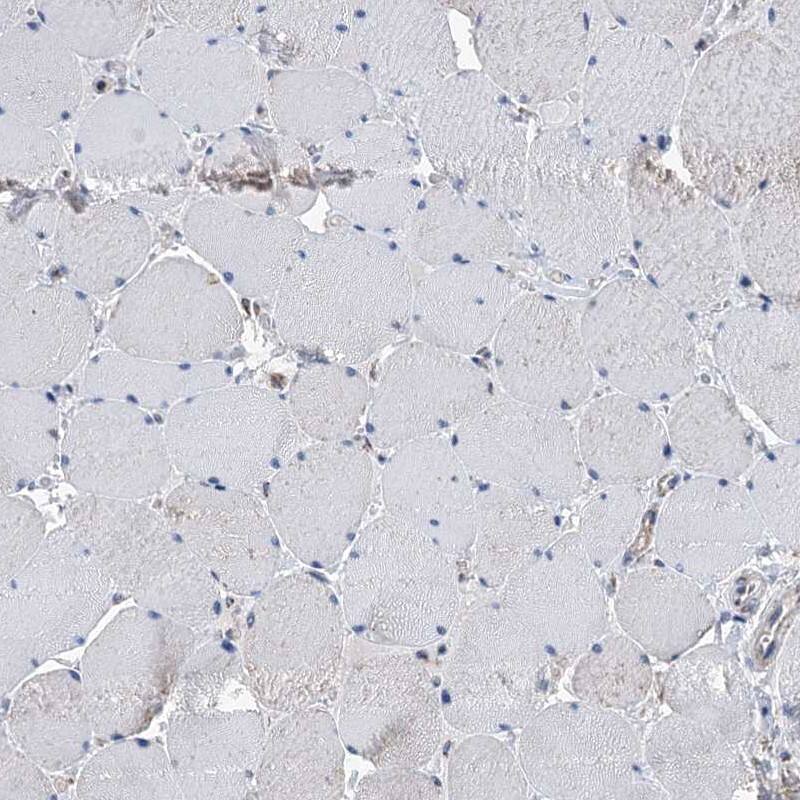 Staining of human skeletal muscle shows low expression as expected.