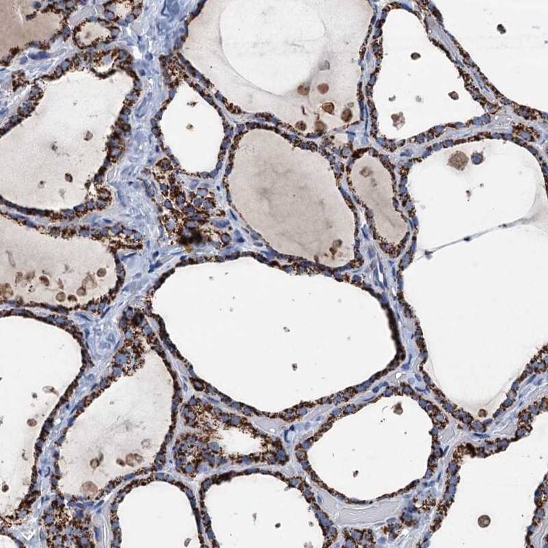 Staining of human thyroid gland shows high expression.