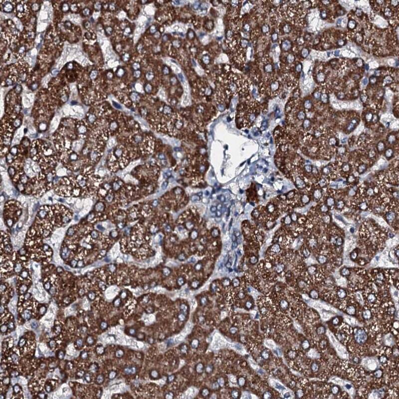 Immunohistochemistry-Paraffin FLJ21963 Antibody - BSA Free