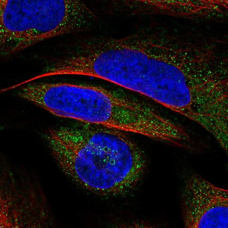 Staining of human cell line U-2 OS shows localization to lipid droplets.