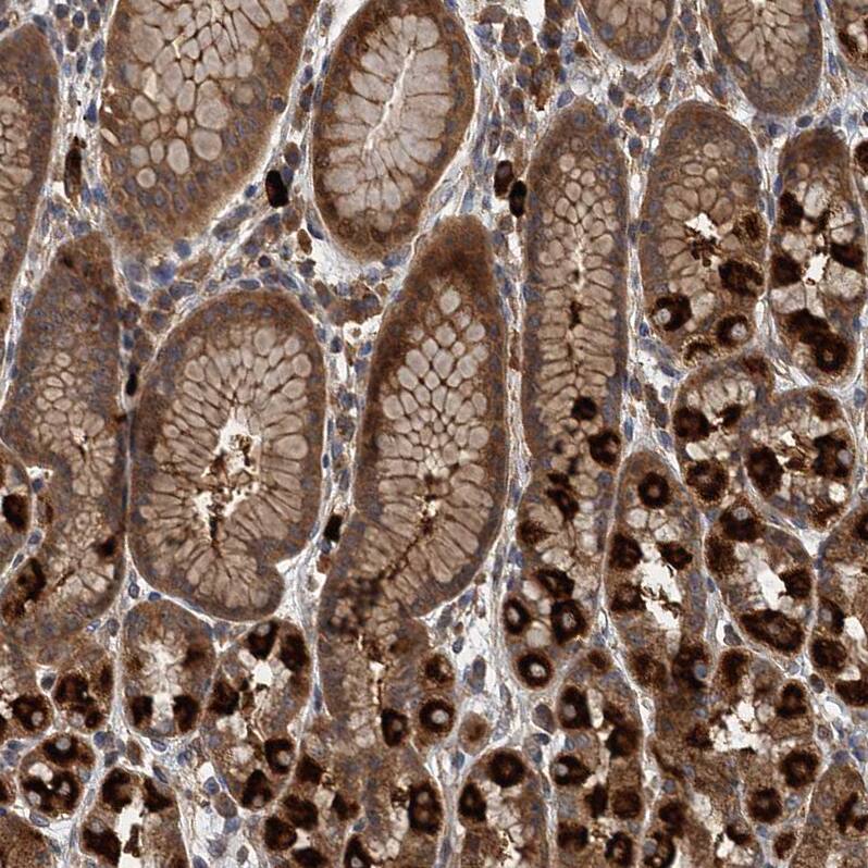 Immunohistochemistry-Paraffin LOH12CR1 Antibody - BSA Free
