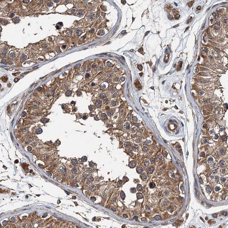 Staining of human testis shows moderate cytoplasmic positivity in cells in seminiferous ducts.