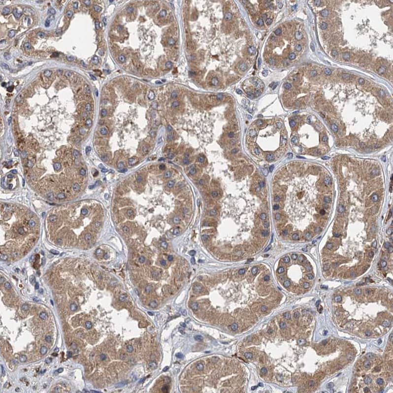 Staining of human kidney shows weak cytoplasmic positivity in cells in tubules.
