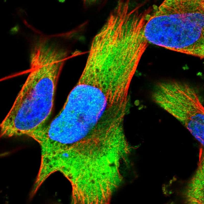 Staining of human cell line U-251 MG shows localization to nucleoplasm & cytosol.