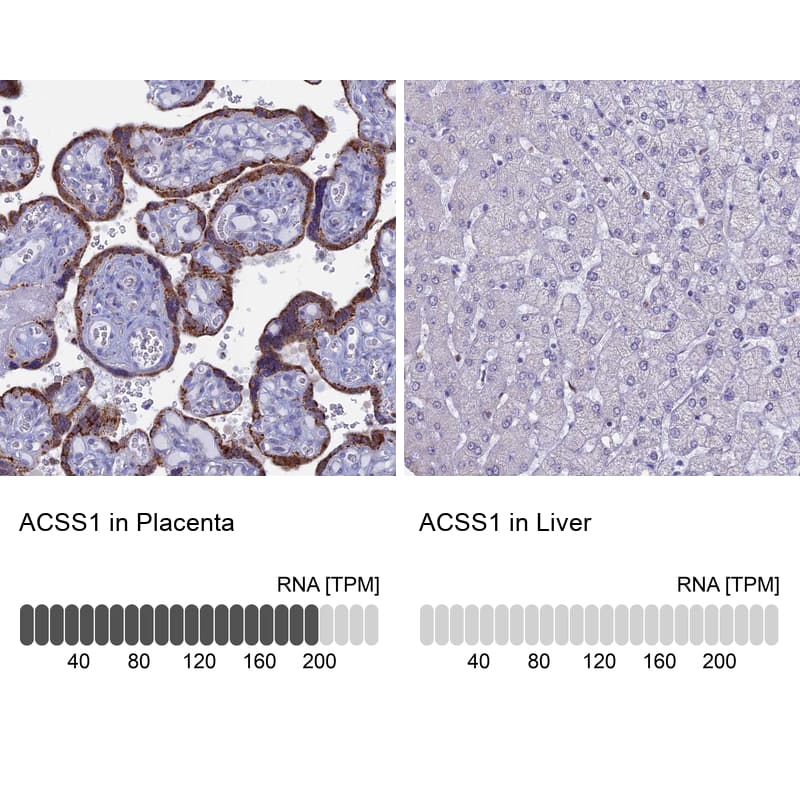 Analysis in human placenta and liver tissues. Corresponding RNA-seq data are presented for the same tissues.